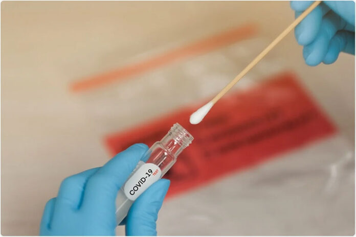 swab-testing